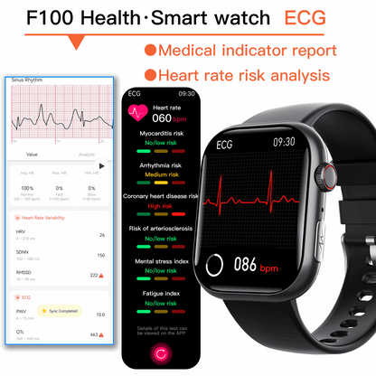 ETERNITY ECG Smart Watch – Heart Rate Monitor, Fall Alarm, Call & Music Features, IP67 Waterproof, iOS Compatible