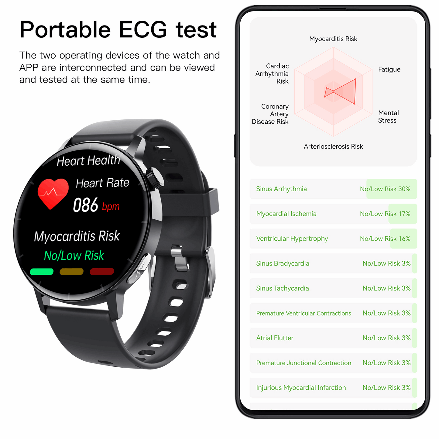 ETERNITY Health ECG Smart Watch – Heart Rate, Blood Oxygen, ECG Monitoring & Message Push