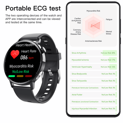 ETERNITY Health ECG Smart Watch – Heart Rate, Blood Oxygen, ECG Monitoring & Message Push