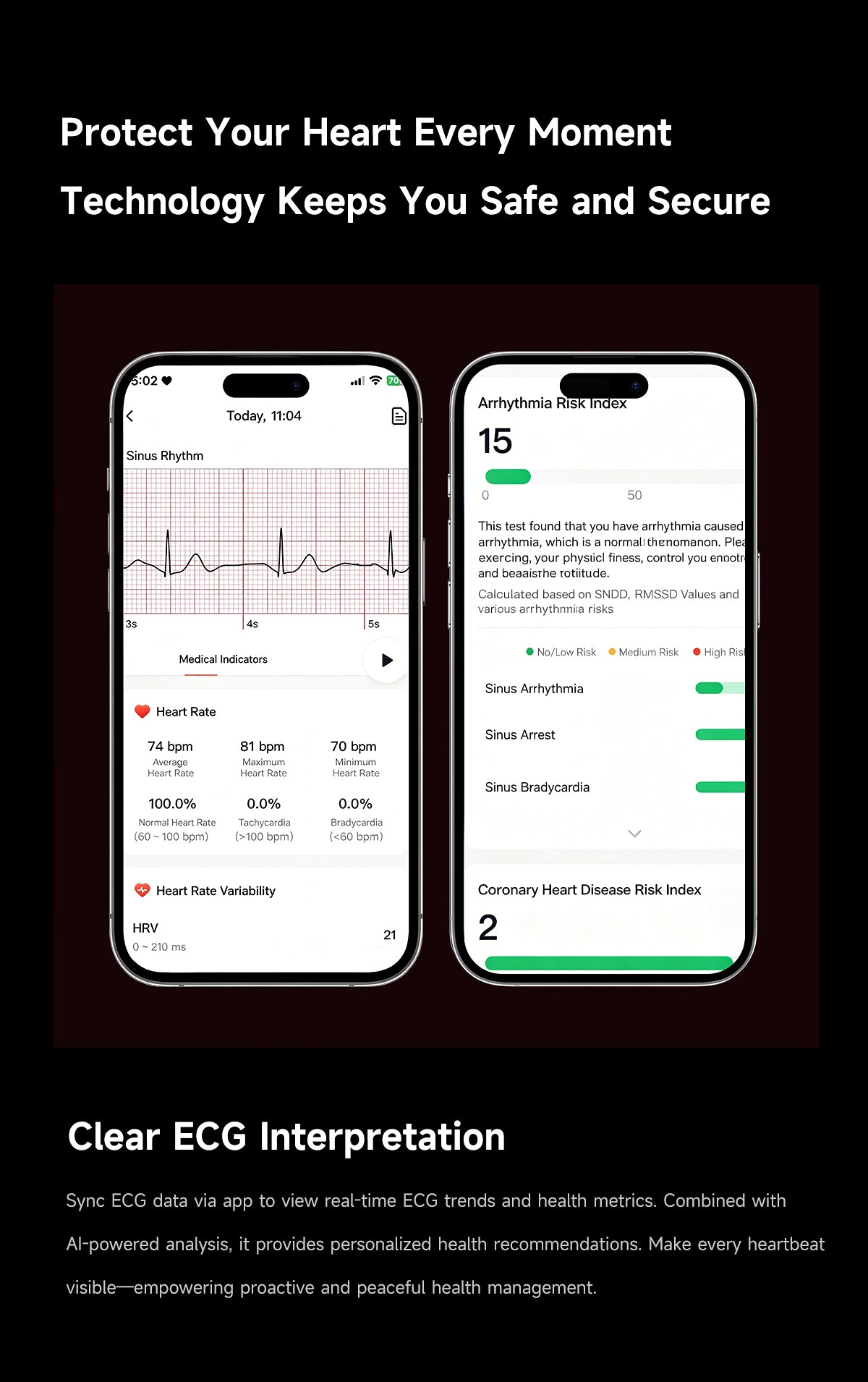 ETERNITY No Screen Advanced Health Tracker Band with Remote Care ECG and HRV | ETQ17